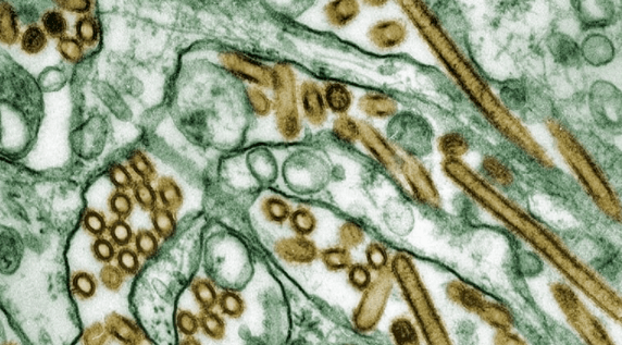 显微镜下的H5N1禽流感病毒，金色